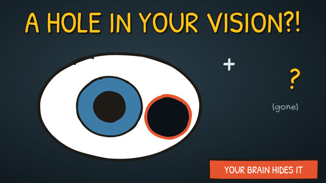 Munchrd: Why do you have a hole in your vision you've never noticed?
