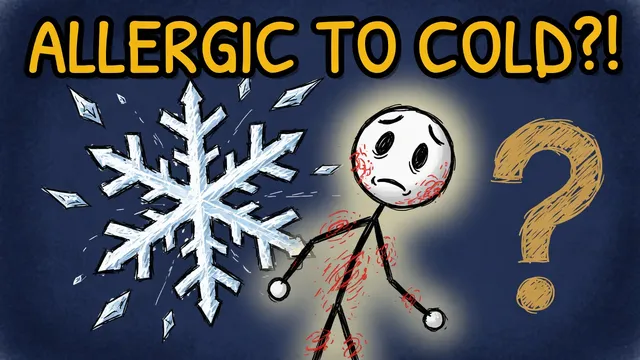 Munchrd: Can you be allergic to the cold?