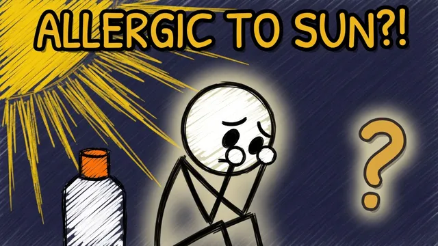Munchrd: Can you be allergic to the sun?