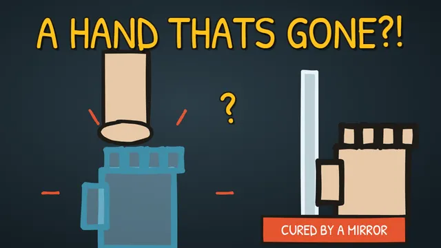 Munchrd: Why do amputees feel a limb that's gone?