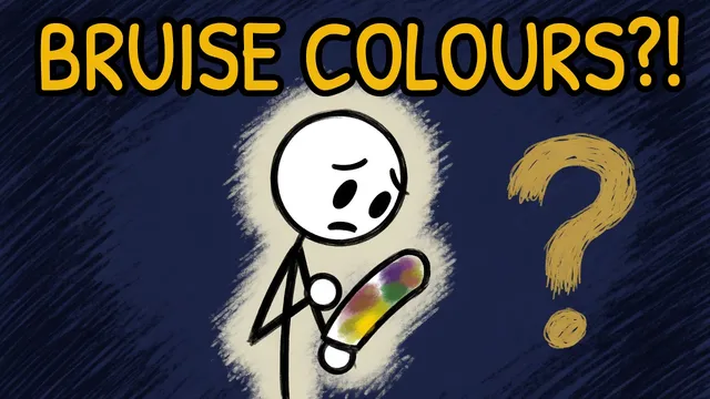 Munchrd: Why do bruises change colour as they heal?