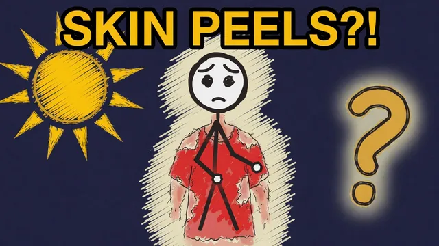 Munchrd: Why does your skin peel after sunburn?